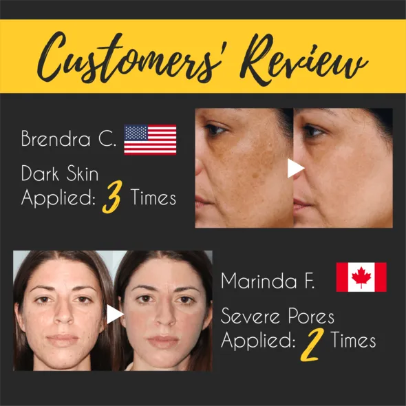 24K Gold Rejuvenating Peel Off Mask