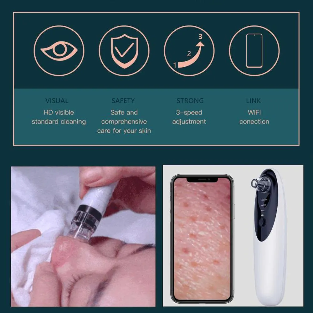 Blackhead Remover Vacuum with WiFi Camera, x10 Zoom Microscope Facial Tools with 3 Blackhead Sucker, Electric Blackhead Remover