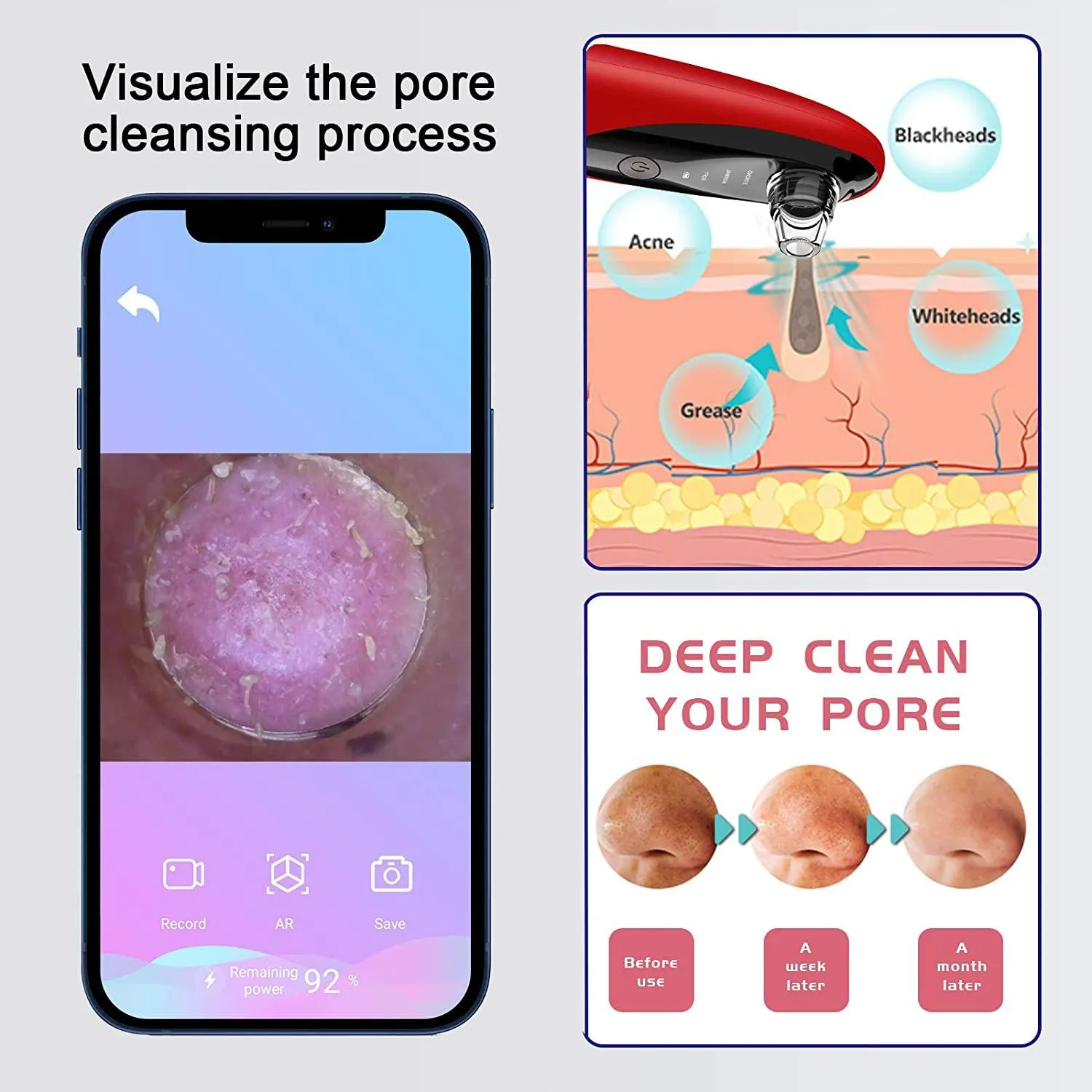Blackhead Remover Vacuum with WiFi Camera, x10 Zoom Microscope Facial Tools with 3 Blackhead Sucker, Electric Blackhead Remover