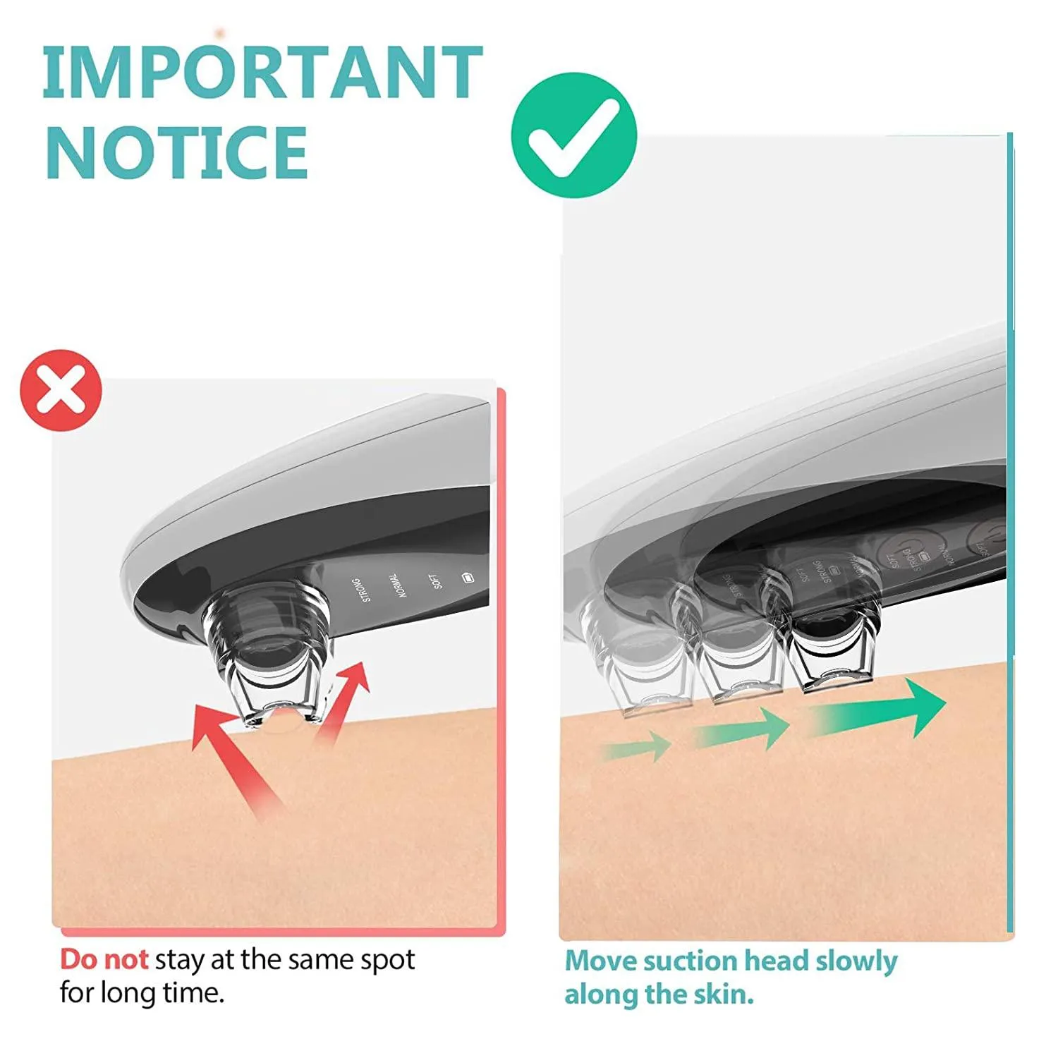 Blackhead Remover Vacuum with WiFi Camera, x10 Zoom Microscope Facial Tools with 3 Blackhead Sucker, Electric Blackhead Remover