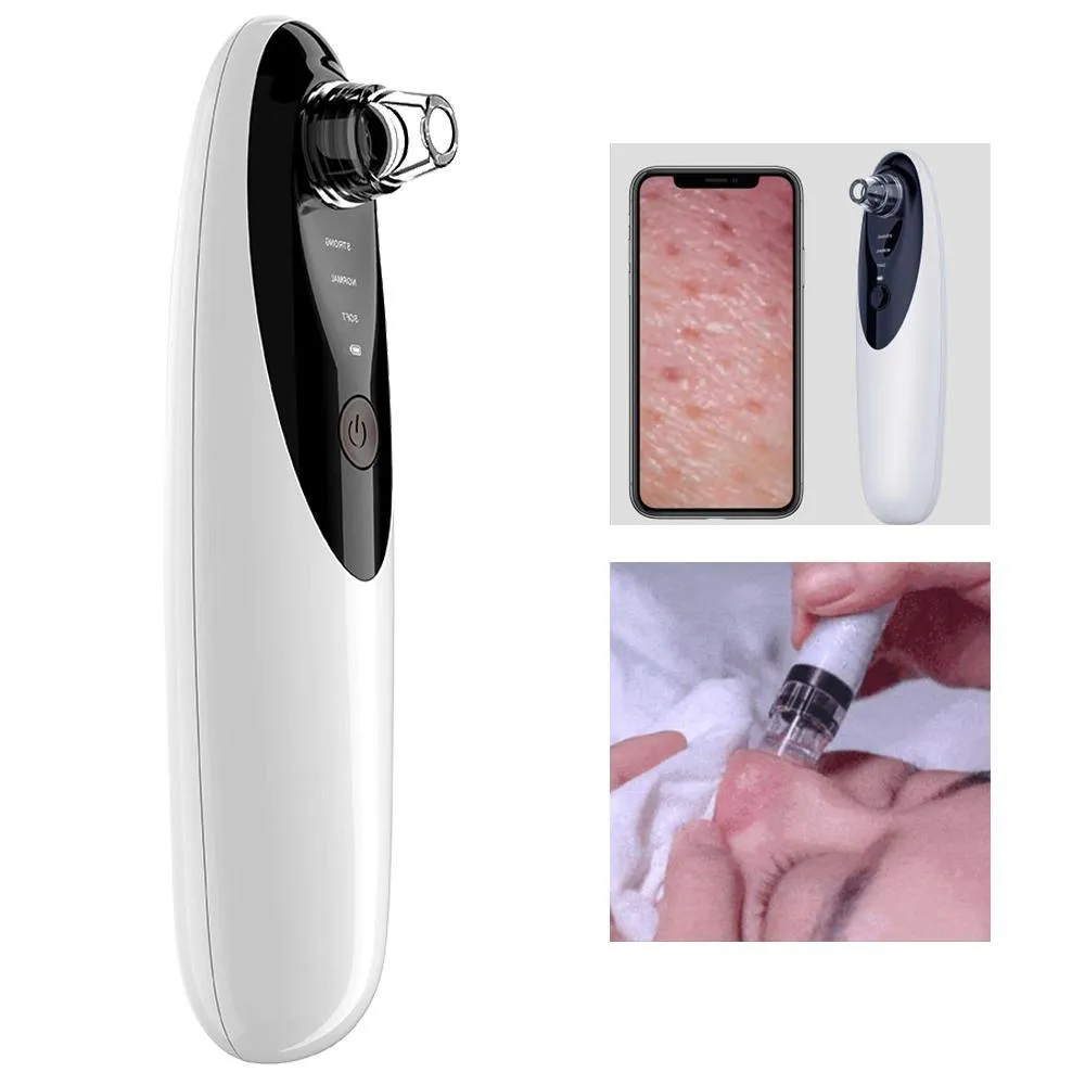 Blackhead Remover Vacuum with WiFi Camera, x10 Zoom Microscope Facial Tools with 3 Blackhead Sucker, Electric Blackhead Remover