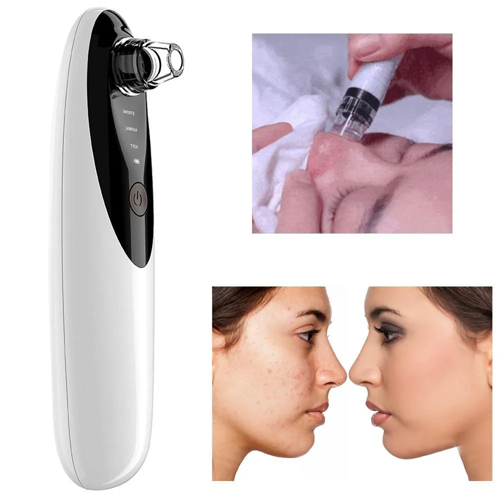 Blackhead Remover Vacuum with WiFi Camera, x10 Zoom Microscope Facial Tools with 3 Blackhead Sucker, Electric Blackhead Remover