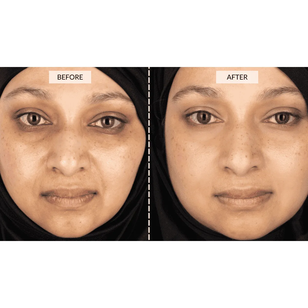 CurrentBody Skin LED 4-in-1 Zone Facial Mapping Mask