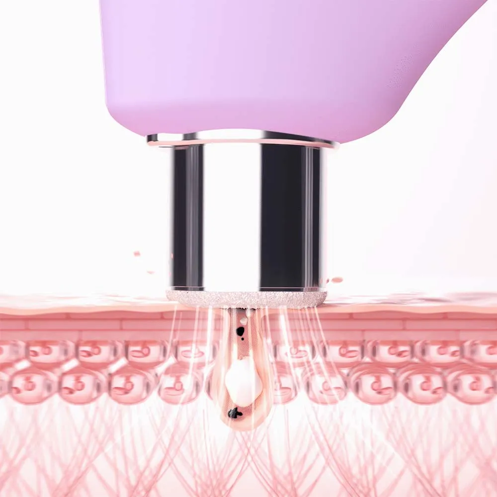 KIWI™ derma