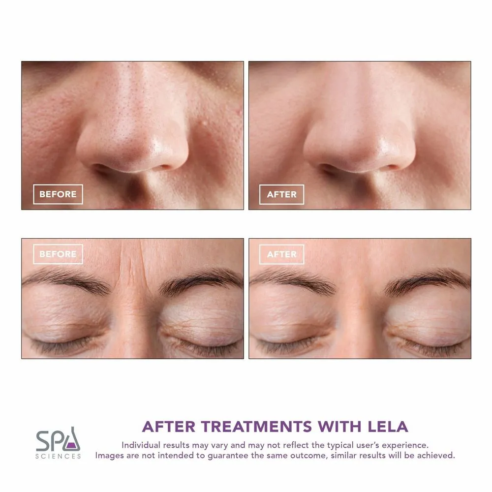 New - Spa Sciences LELA Ultrasonic Facial Spatula System - Pink