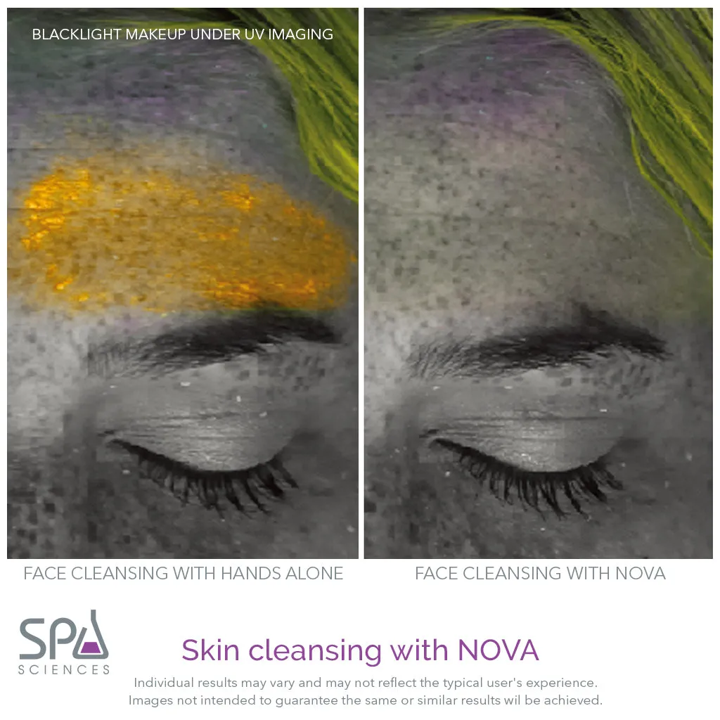 NOVA