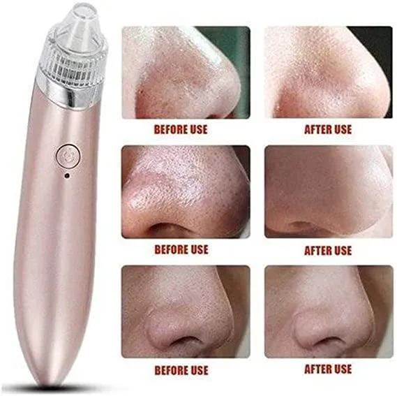 Portable Ultrasonic XN-8030 Electric Blackhead Vacuum Cleaner