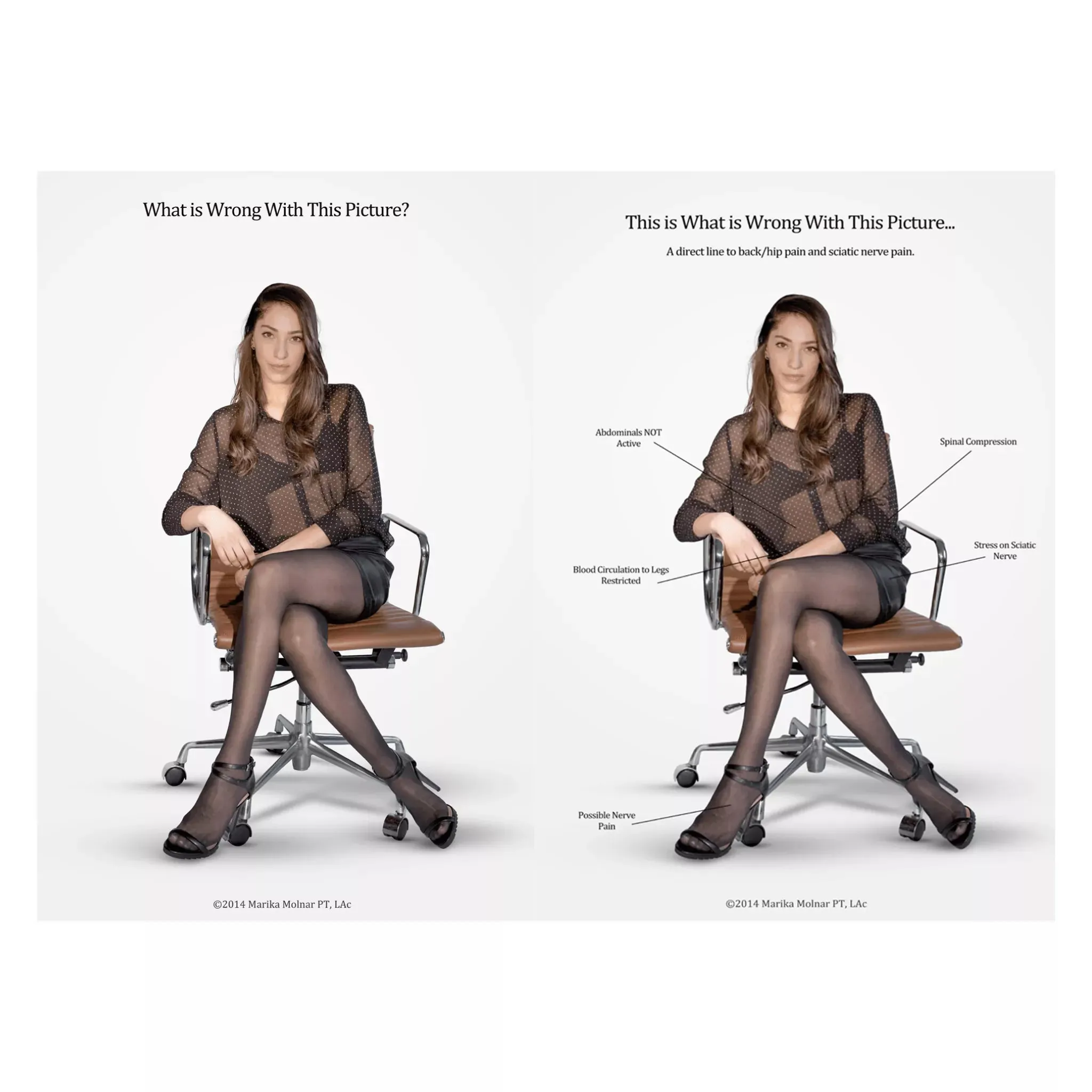 SMARTSEAT™ and Wedges